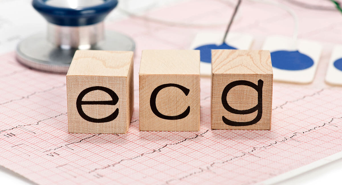 Experto universitario en electrocardiografía