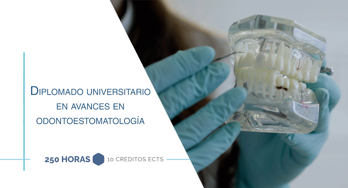 Diplomado Universitario en Avances en odontoestomatología
