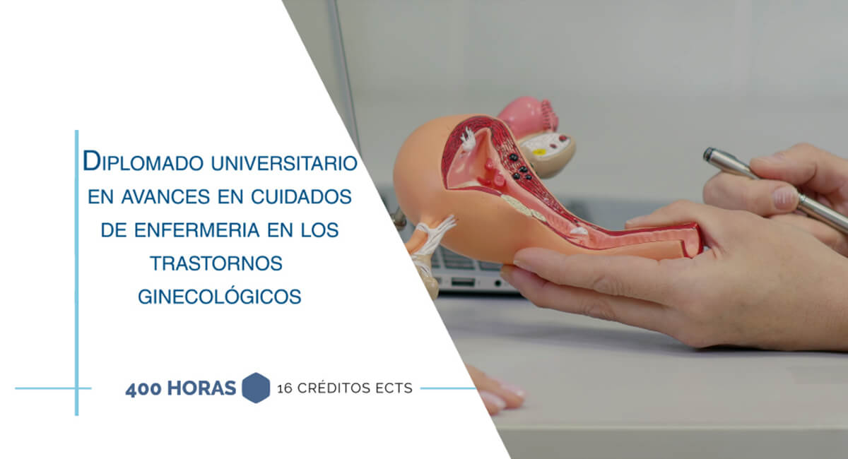 Diplomado Universitario en Avances en cuidados de enfermería en los trastornos ginecológicos