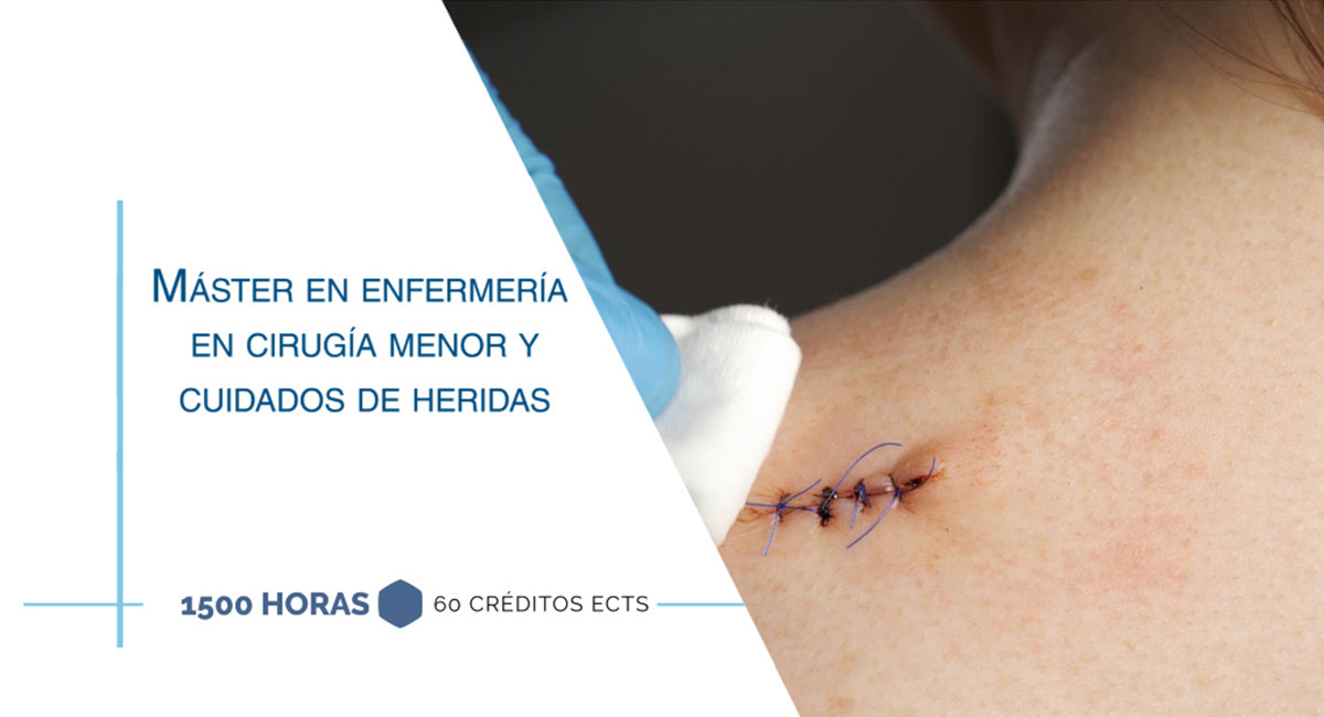 Máster en enfermería en cirugía menor y cuidados de heridas