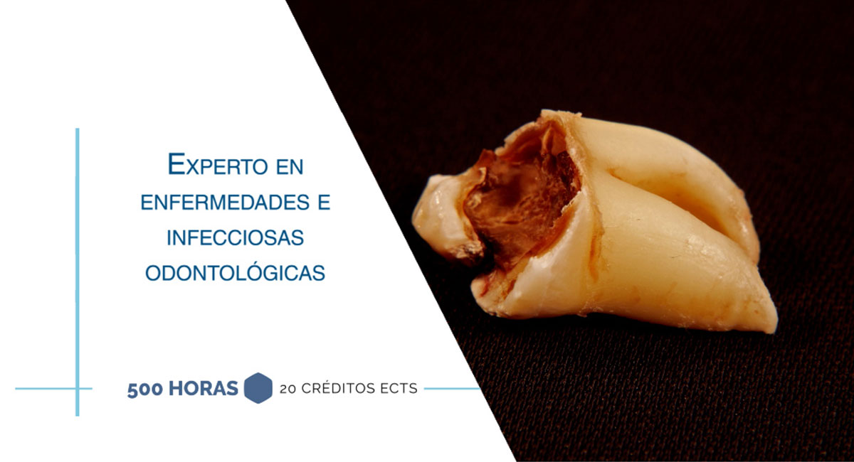 Experto en enfermedades e infecciosas odontológicas