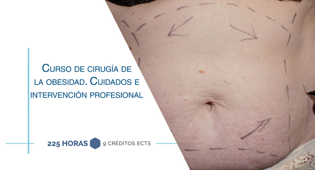 Curso internacional de cirugía de la obesidad. Cuidados e Intervención profesional
