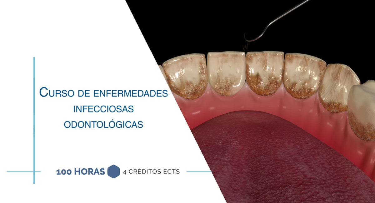 Curso internacional de enfermedades infecciosas odontológicas