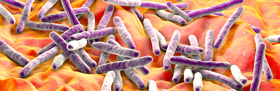 Curso Superior Universitario en Avances en enfermedades infecciosas producidas por micobacterias