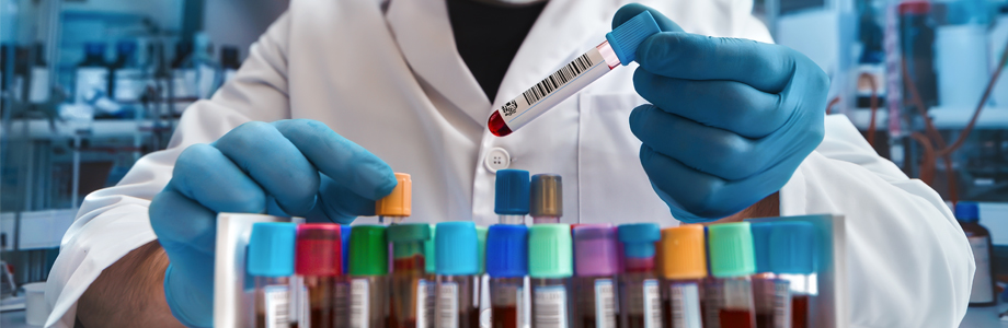 Curso Superior Universitario en actualización en hematología y bioquímica