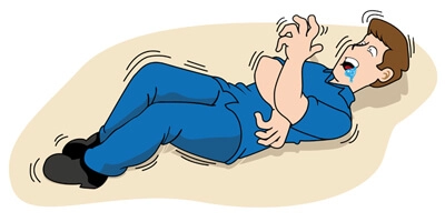 Una convulsión puede afectar al cuerpo entero o limitarse a una parte determinada.