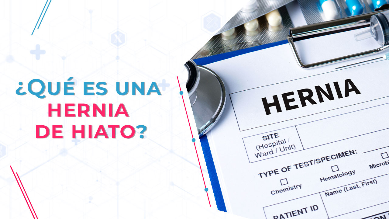 ¿qué Es Una Hernia De Hiato