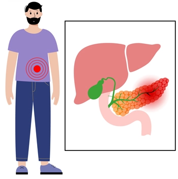 Los químicos digestivos (enzimas) que se producen en el páncreas se activan y comienzan a “digerir” partes del páncreas.