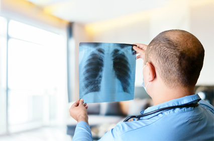 Los rayos X producen imágenes del corazón, pulmones, vasos sanguíneos, vías respiratorias y los huesos del pecho y columna vertebral.