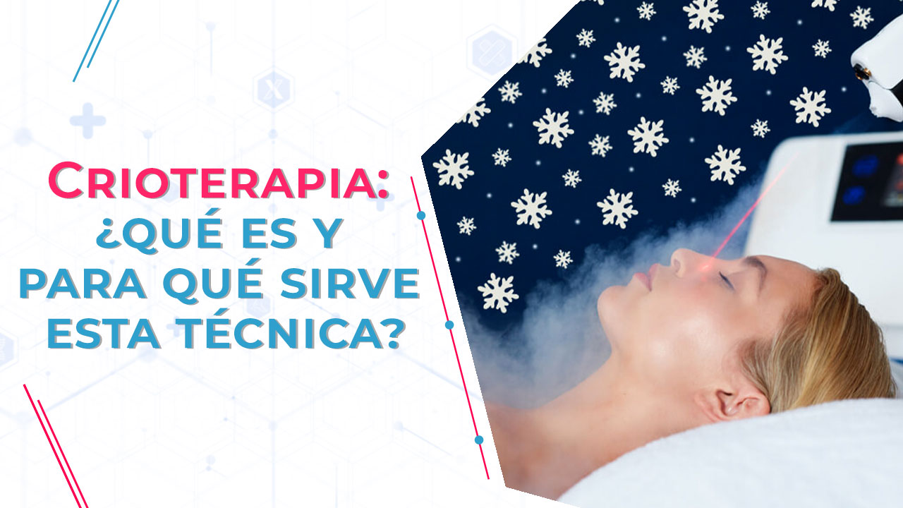 Crioterapia.