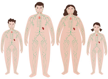 Tipos de linfedema que existen