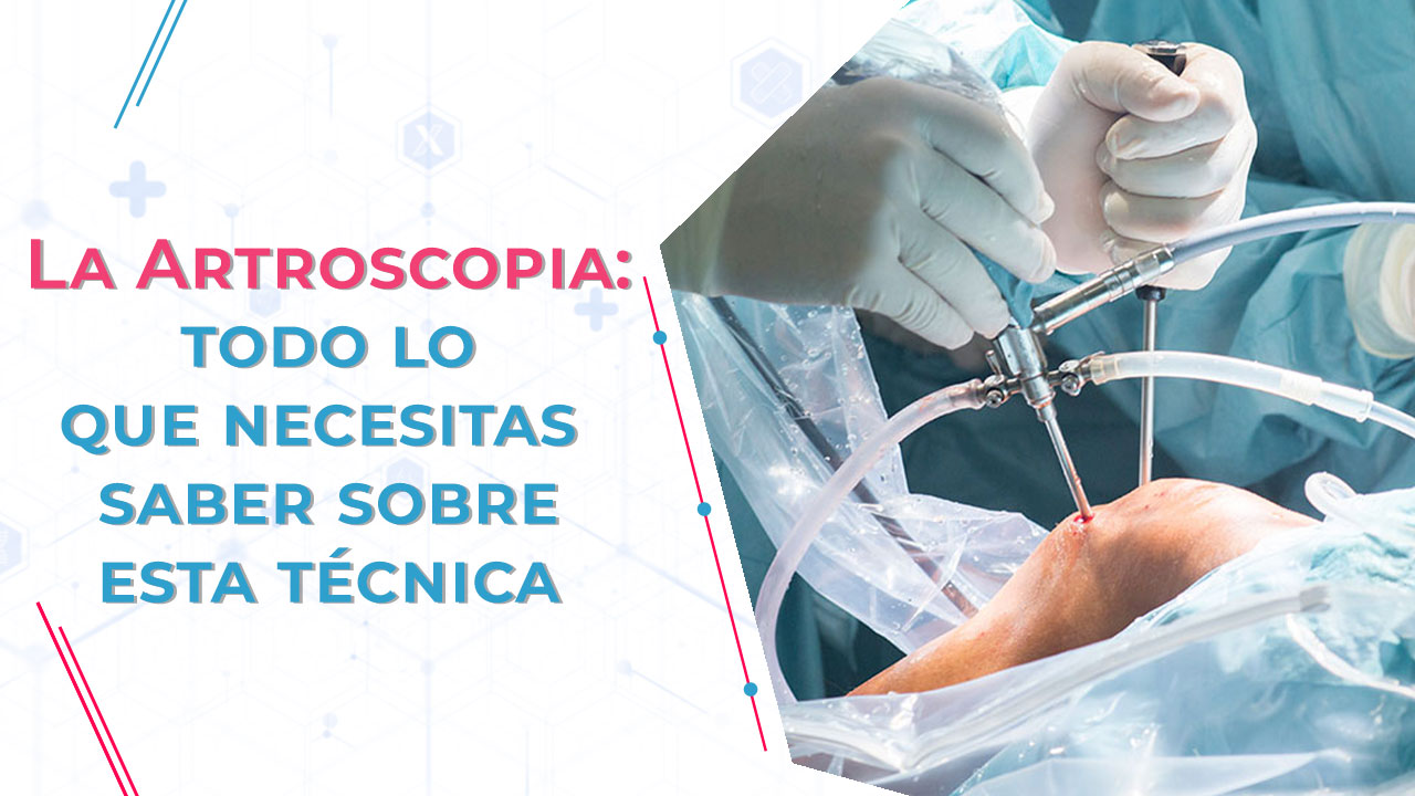 Artroscopia - Todo sobre esta Técnica