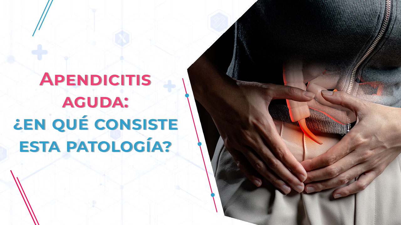 Apendicitis aguda: ¿en qué consiste esta patología?