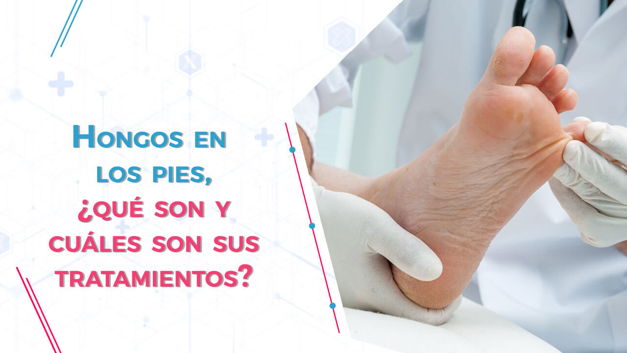 Hongos en los pies, ¿qué son y cuáles son sus tratamientos?