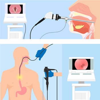 Existen varias pruebas que se utilizan para diagnosticar la disfagia.