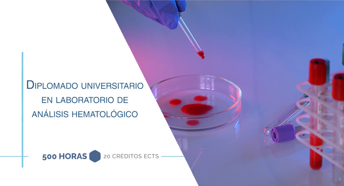 Diplomado Universitario en Laboratorio de Análisis Hematológico