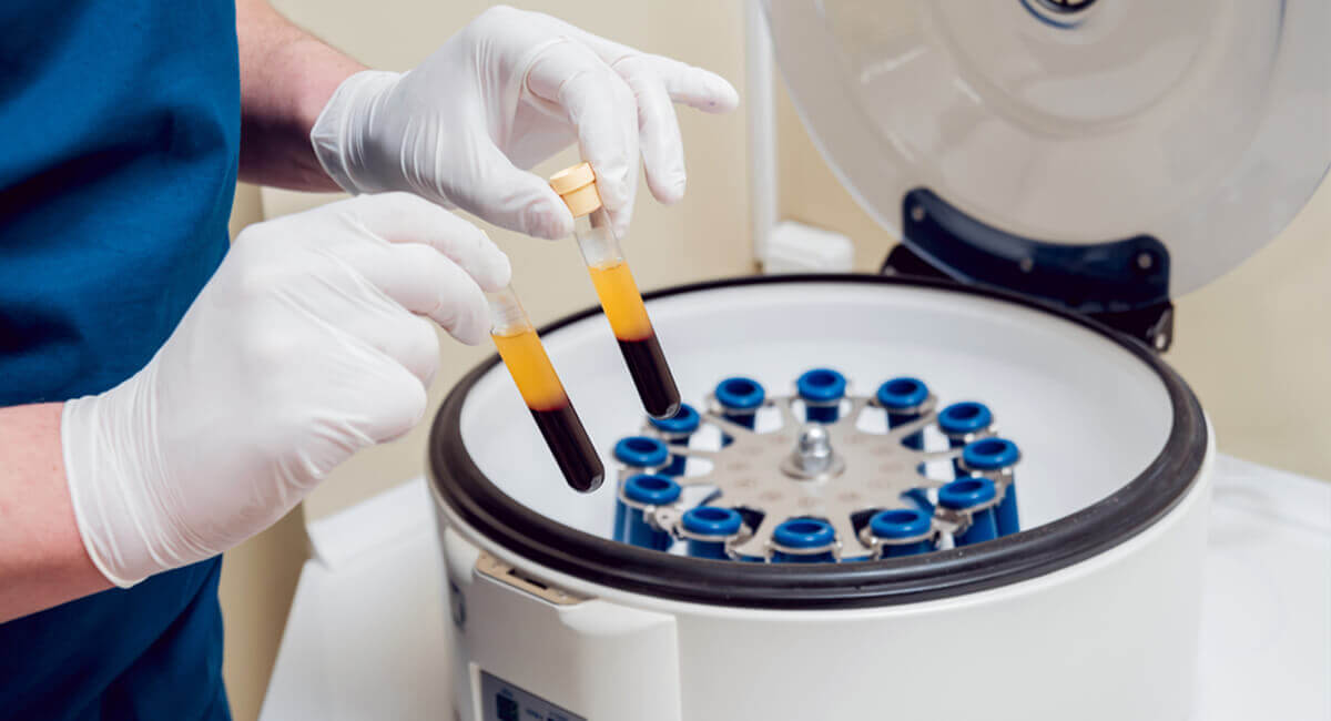 Curso internacional en Tratamiento con plasma rico en plaquetas