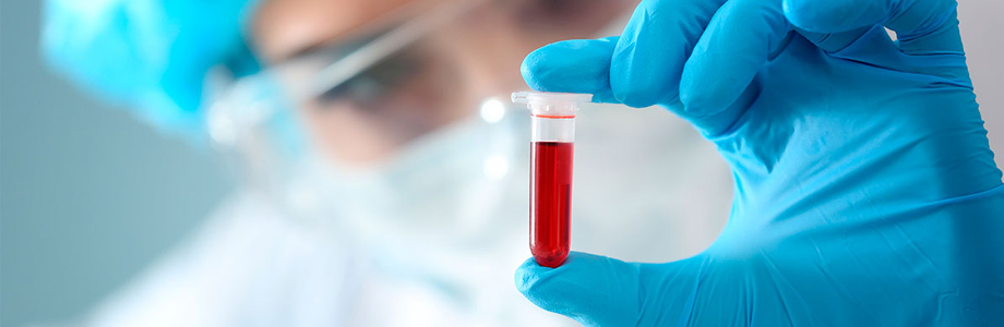 Experto Universitario en Microbiología y Recogida de Muestras Infecciosas